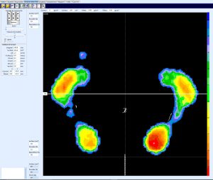 Bilan Postural